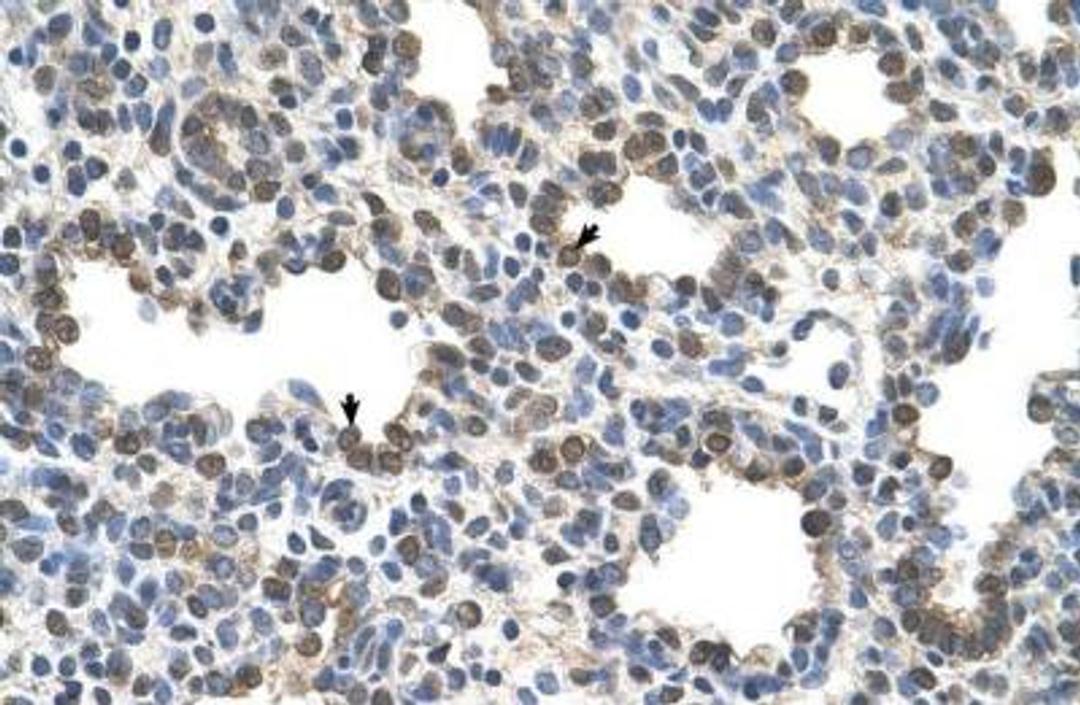 Immunohistochemistry-Paraffin: Butyrylcholinesterase/BCHE Antibody [NBP1-69541] - Human Lung.