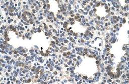 Immunohistochemistry-Paraffin: Butyrylcholinesterase/BCHE Antibody [NBP1-69541] - Human Lung.