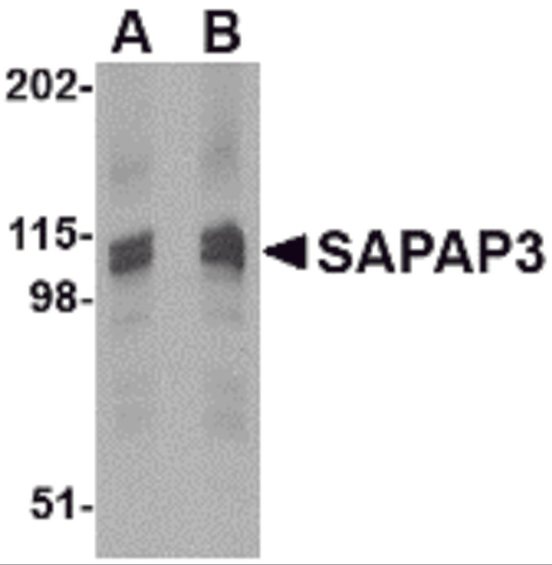 Western blot analysis of SAPAP3 in rat brain tissue lysate with SAPAP3 antibody at (A) 1 (B) 2 μg/mL.