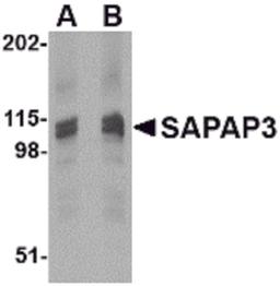 Western blot analysis of SAPAP3 in rat brain tissue lysate with SAPAP3 antibody at (A) 1 (B) 2 μg/mL.