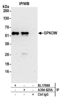 Detection of human GPKOW by western blot of immunoprecipitates.