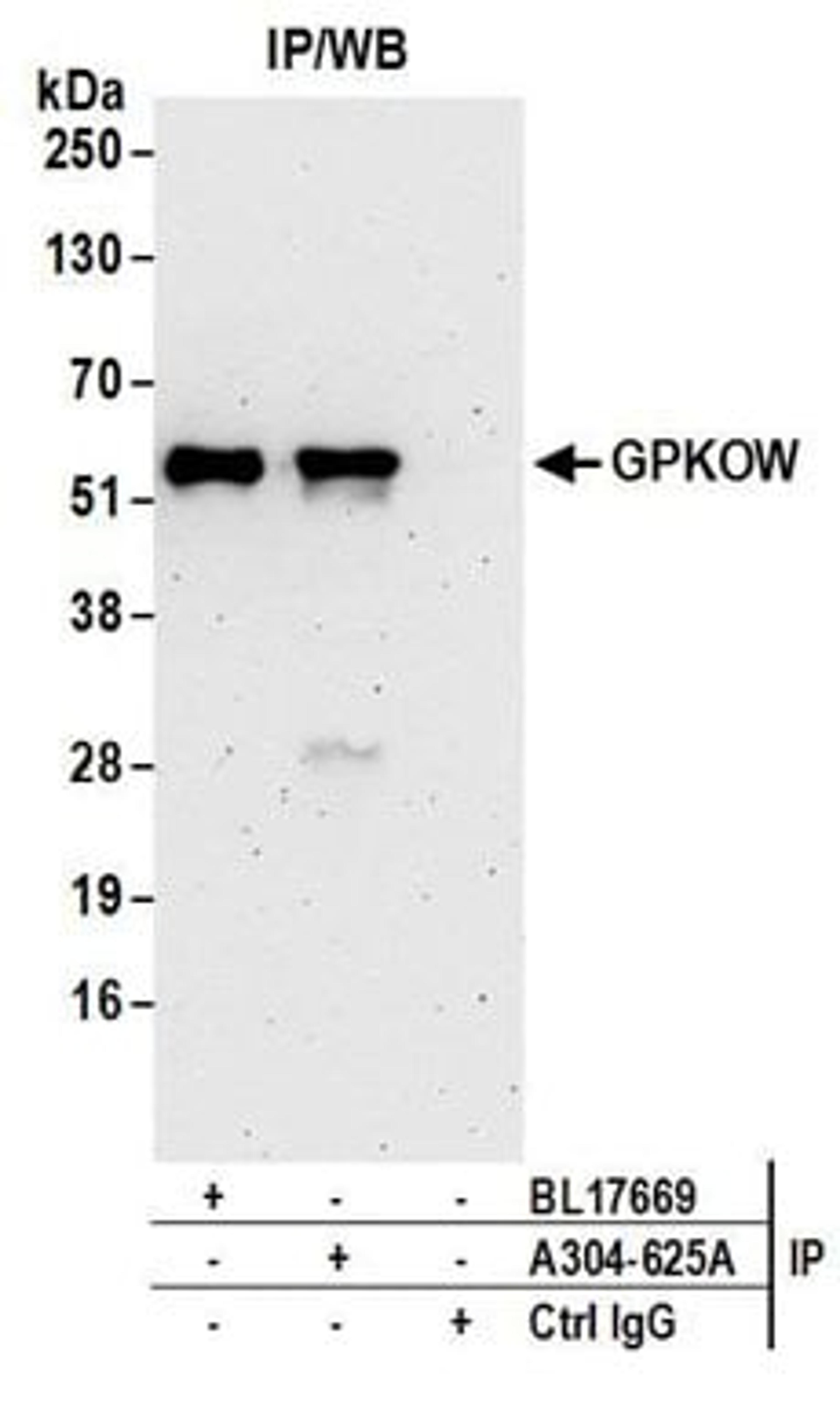 Detection of human GPKOW by western blot of immunoprecipitates.