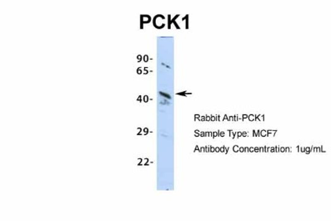 Western Blot: PCK1 Antibody [NBP1-54825] - MCF7, Antibody Dilution: 1.0 ug/ml.