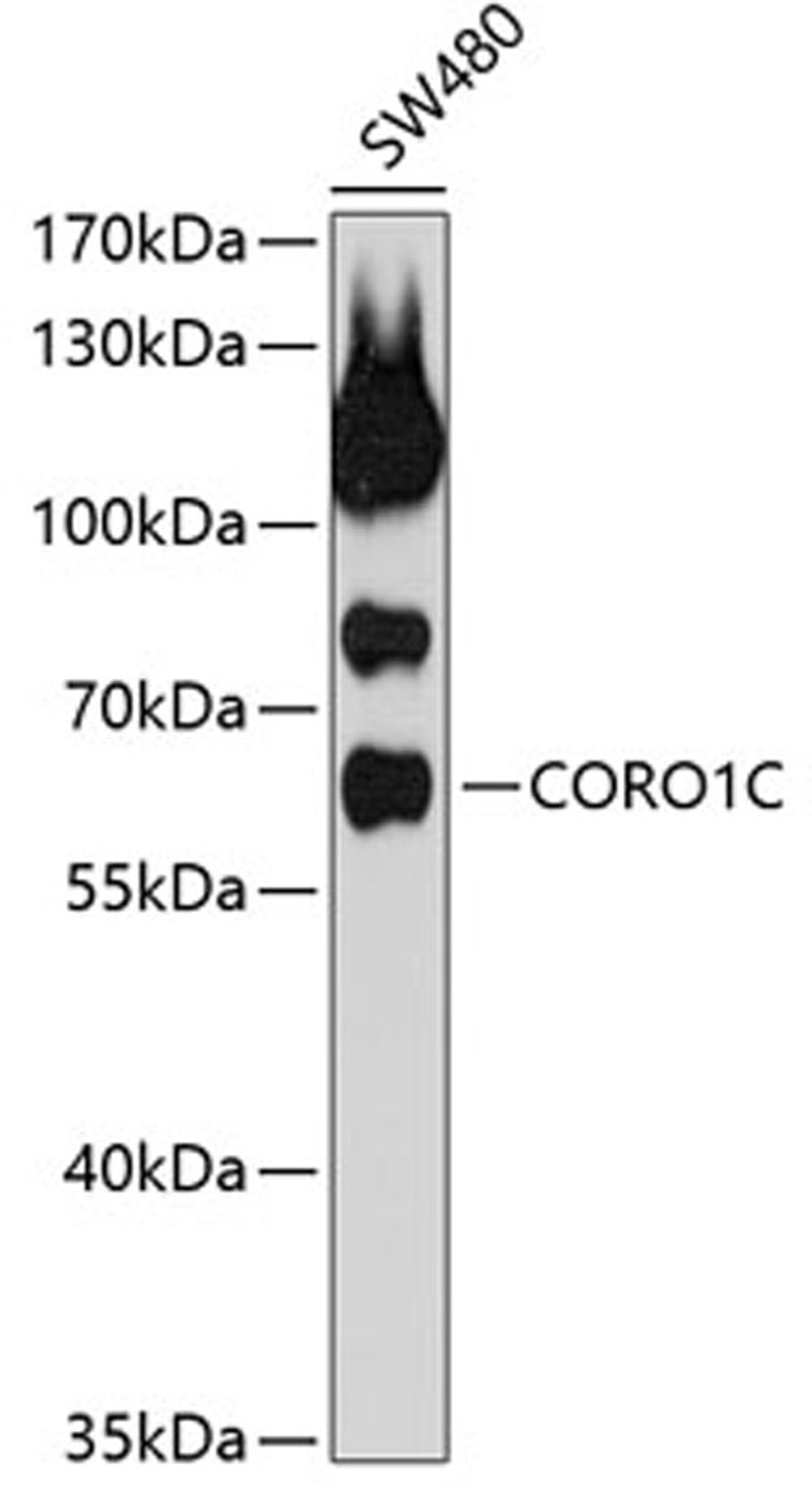 Western blot - CORO1C antibody (A4568)