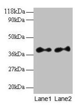 Western blot. All lanes: SCAMP3 antibody at 2µg/ml. Lane 1: EC109 whole cell lysate. Lane 2: 293T whole cell lysate. Secondary. Goat polyclonal to rabbit IgG at 1/15000 dilution. Predicted band size: 39, 36 kDa. Observed band size: 39 kDa