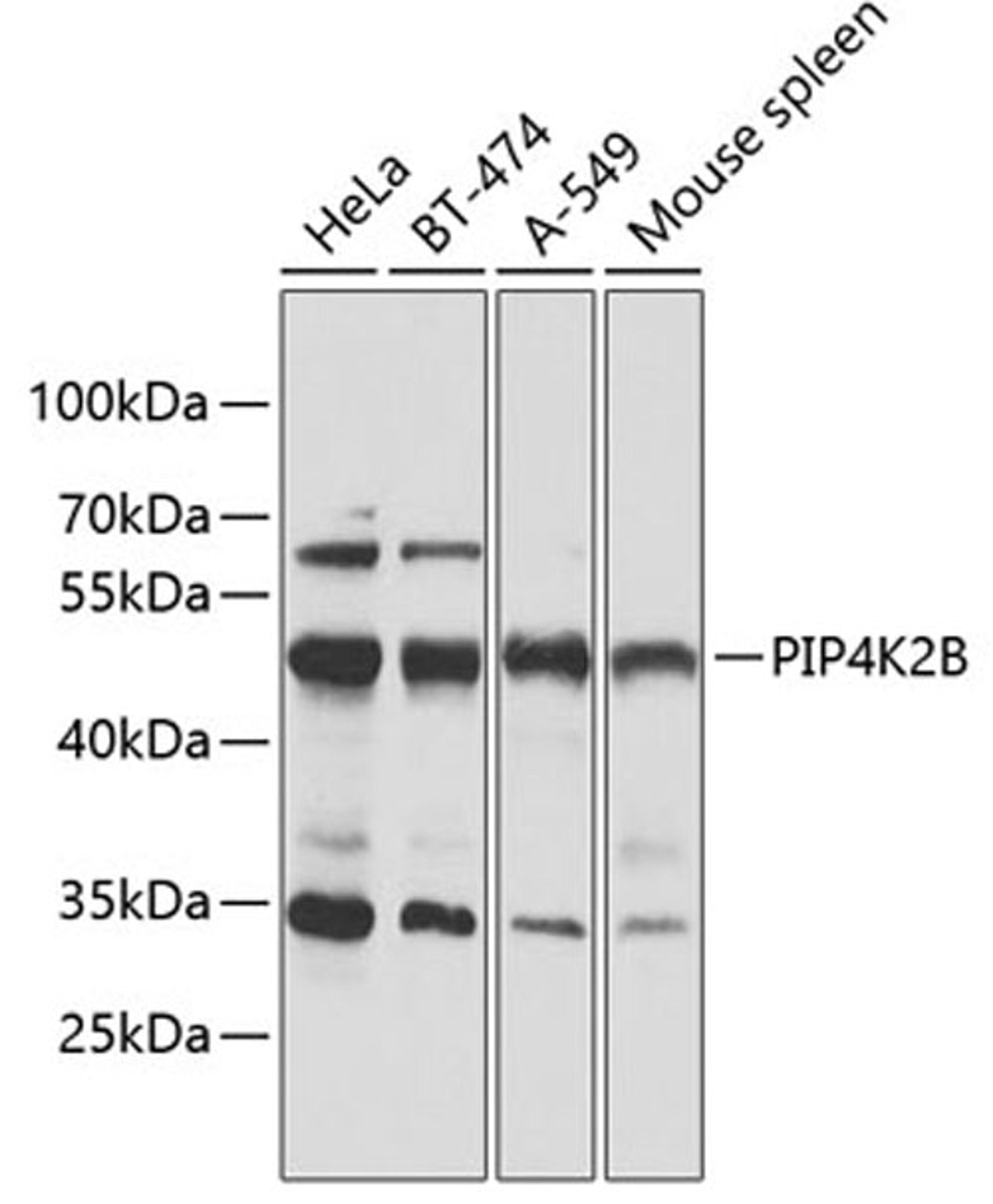 Western blot - PIP4K2B antibody (A12535)