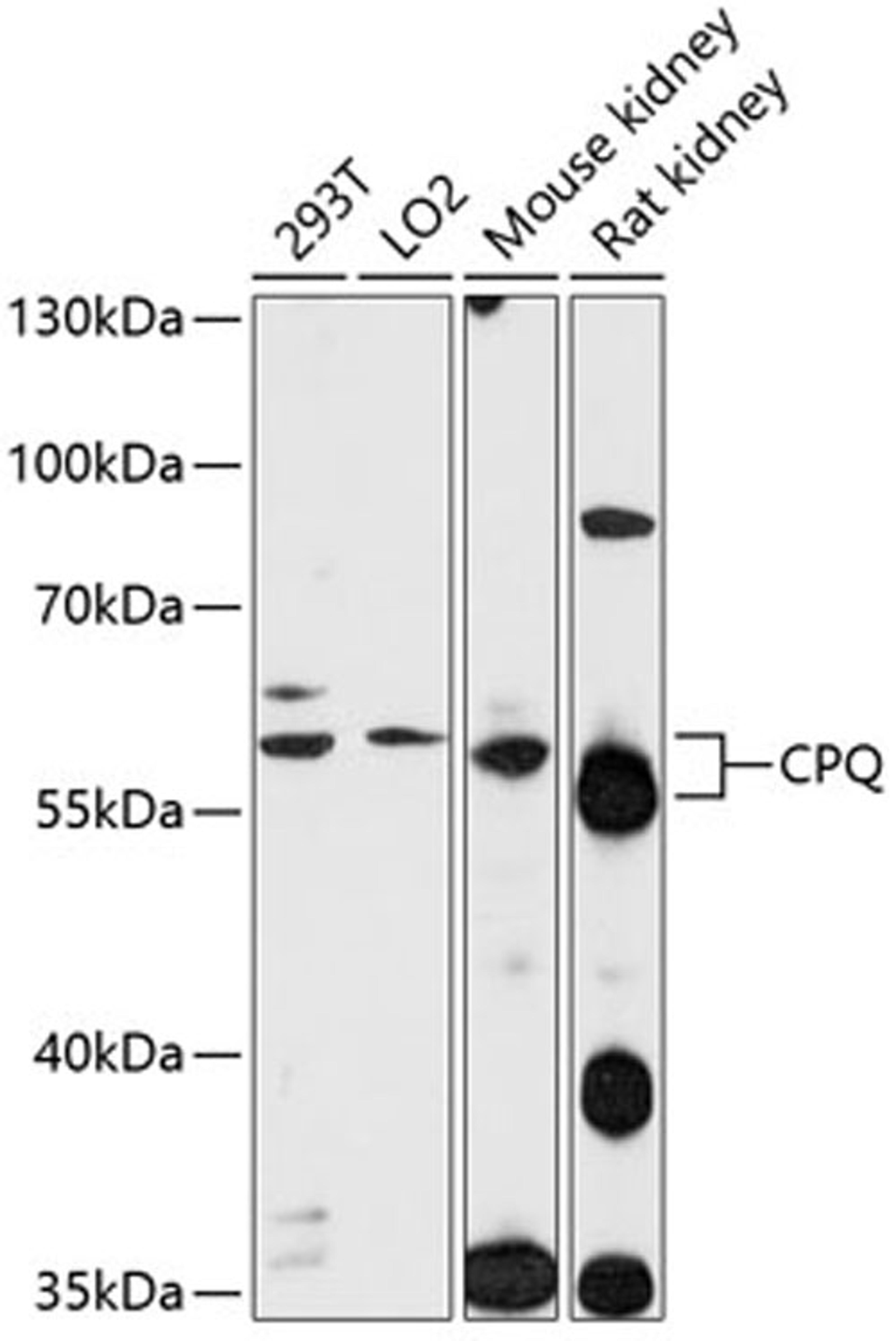 Western blot - CPQ antibody (A12062)