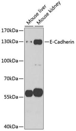 Western blot - E-Cadherin antibody (A11509)