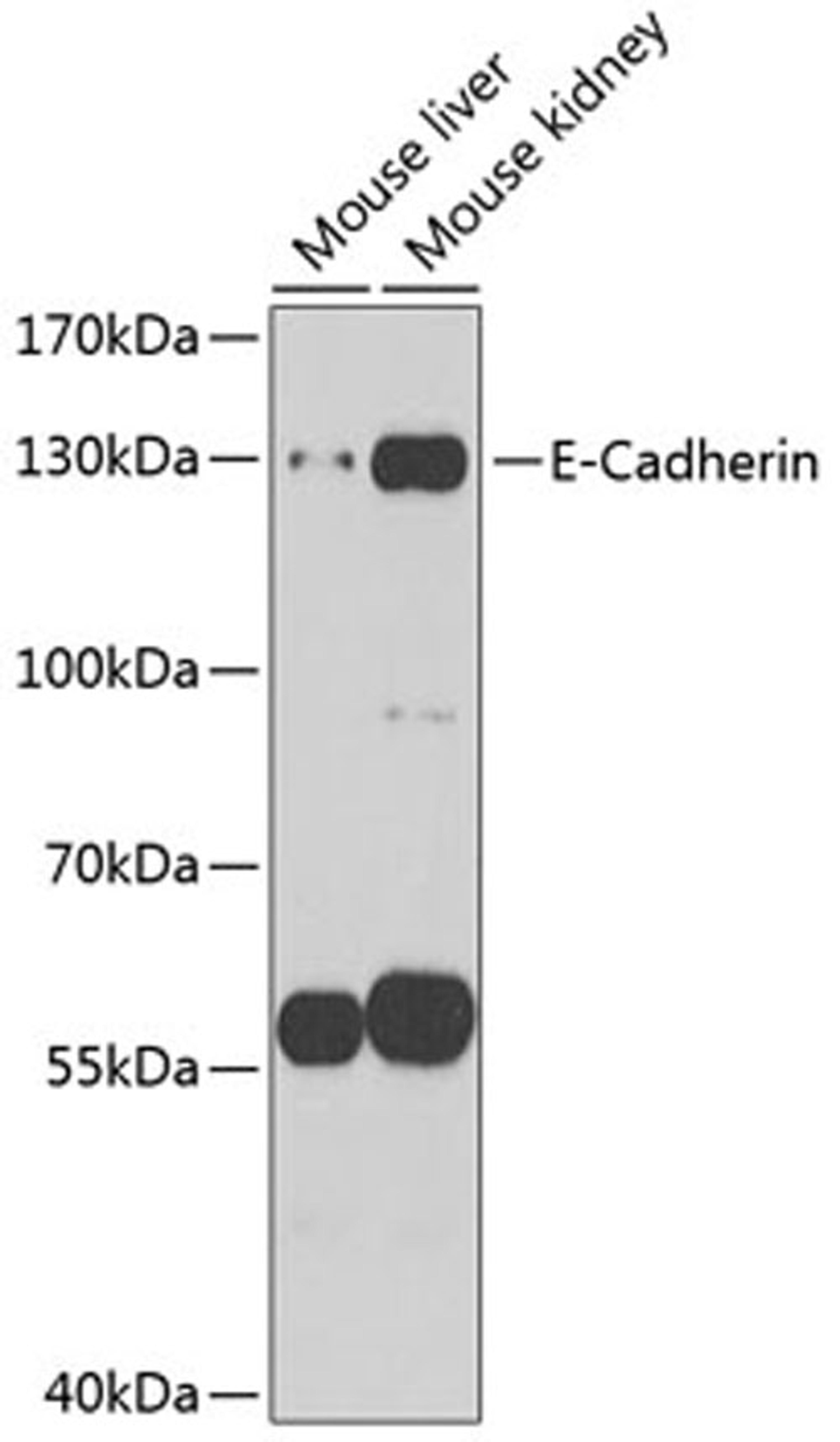 Western blot - E-Cadherin antibody (A11509)