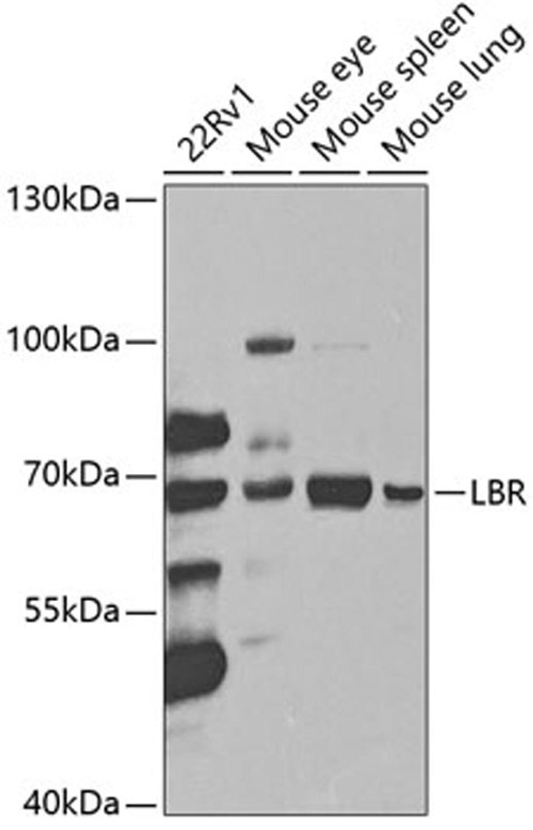 Western blot - LBR antibody (A5468)