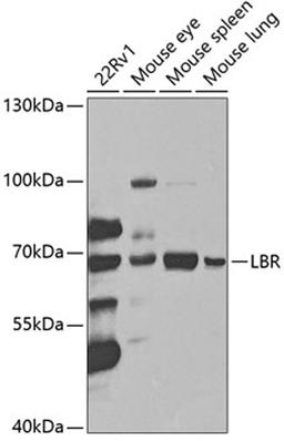 Western blot - LBR antibody (A5468)