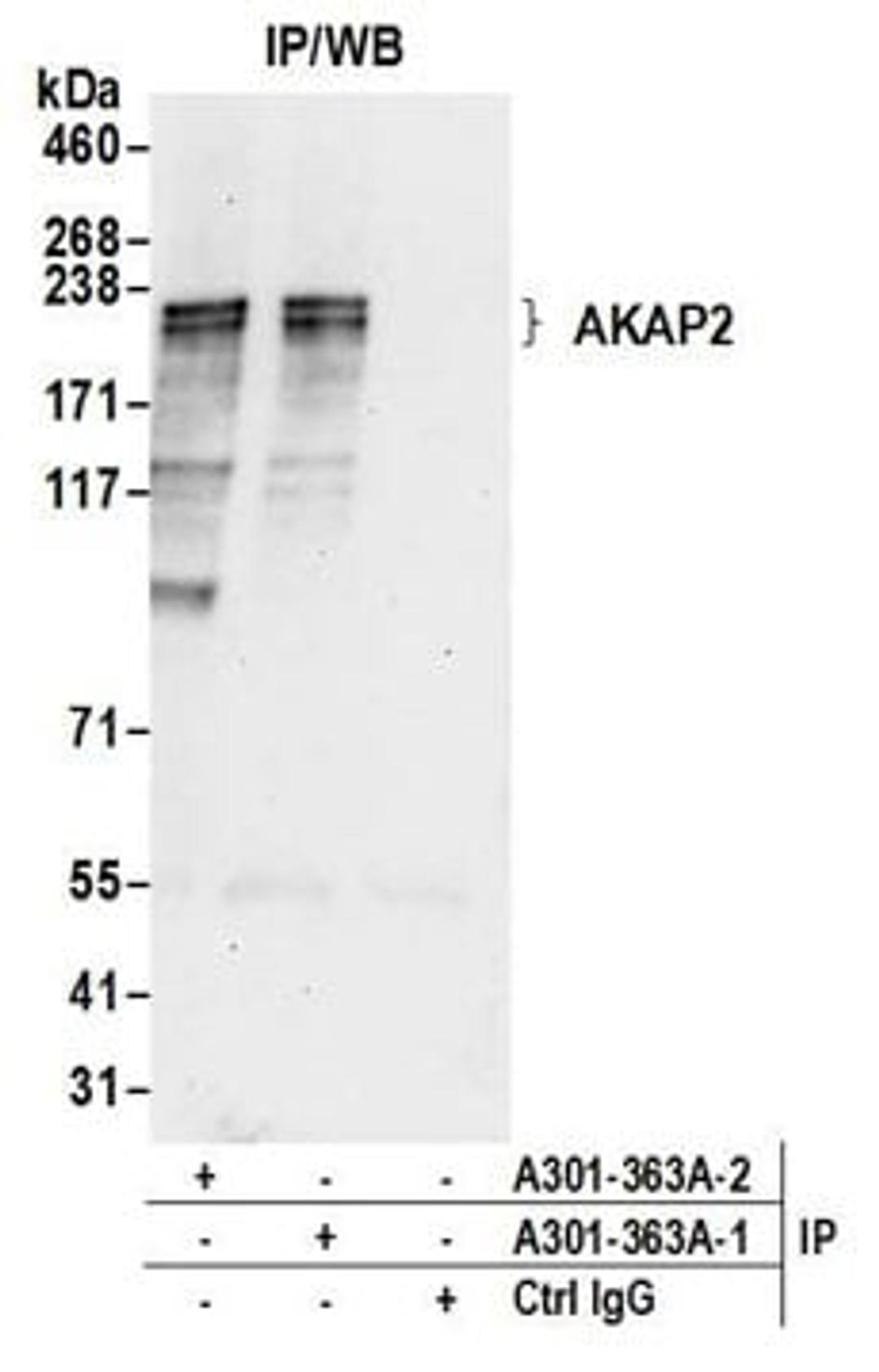 Detection of human AKAP2 by western blot of immunoprecipitates.