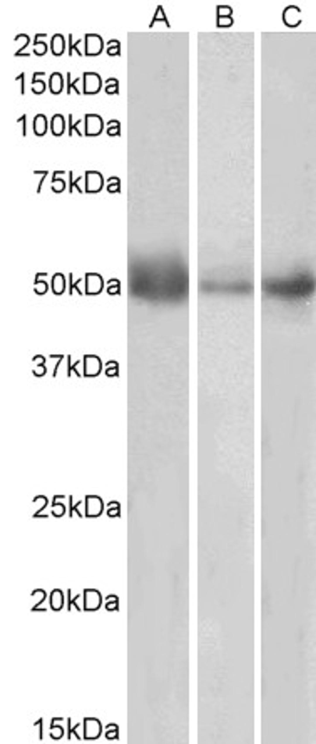 45-773 (0.5ug/ml) staining of Human Lymph Node (A), Spleen (B) and Placenta (C) lysates (35ug protein in RIPA buffer). Primary incubation was 1 hour. Detected by chemiluminescence.