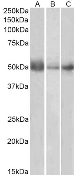 45-773 (0.5ug/ml) staining of Human Lymph Node (A), Spleen (B) and Placenta (C) lysates (35ug protein in RIPA buffer). Primary incubation was 1 hour. Detected by chemiluminescence.