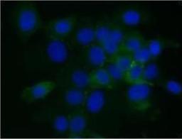 Immunohistochemistry: CPT1B Antibody [NBP1-59576] - searcher: Dr. Pankaj Kumar Singh, UNMC, Omaha, NE Application: IHC Species+tissue/cell type:Species+tissue/cell type: Human Capan1 cells Primary antibody dilution: 1:300 Secondary antibody: Anti-rabbit Alexa Fluor 488 Secondary antibody dilution:1:200