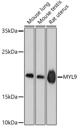 Western blot - MYL9 antibody (A3039)