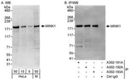 Detection of human and mouse MINK1 by western blot (h&m) and immunoprecipitation (h).