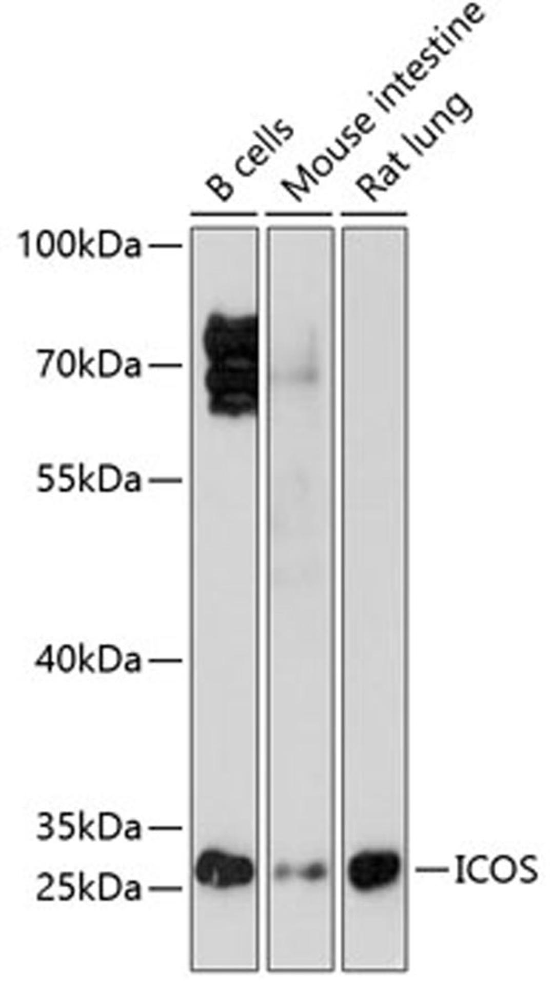 Western blot - ICOS antibody (A1811)