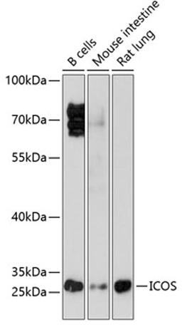 Western blot - ICOS antibody (A1811)