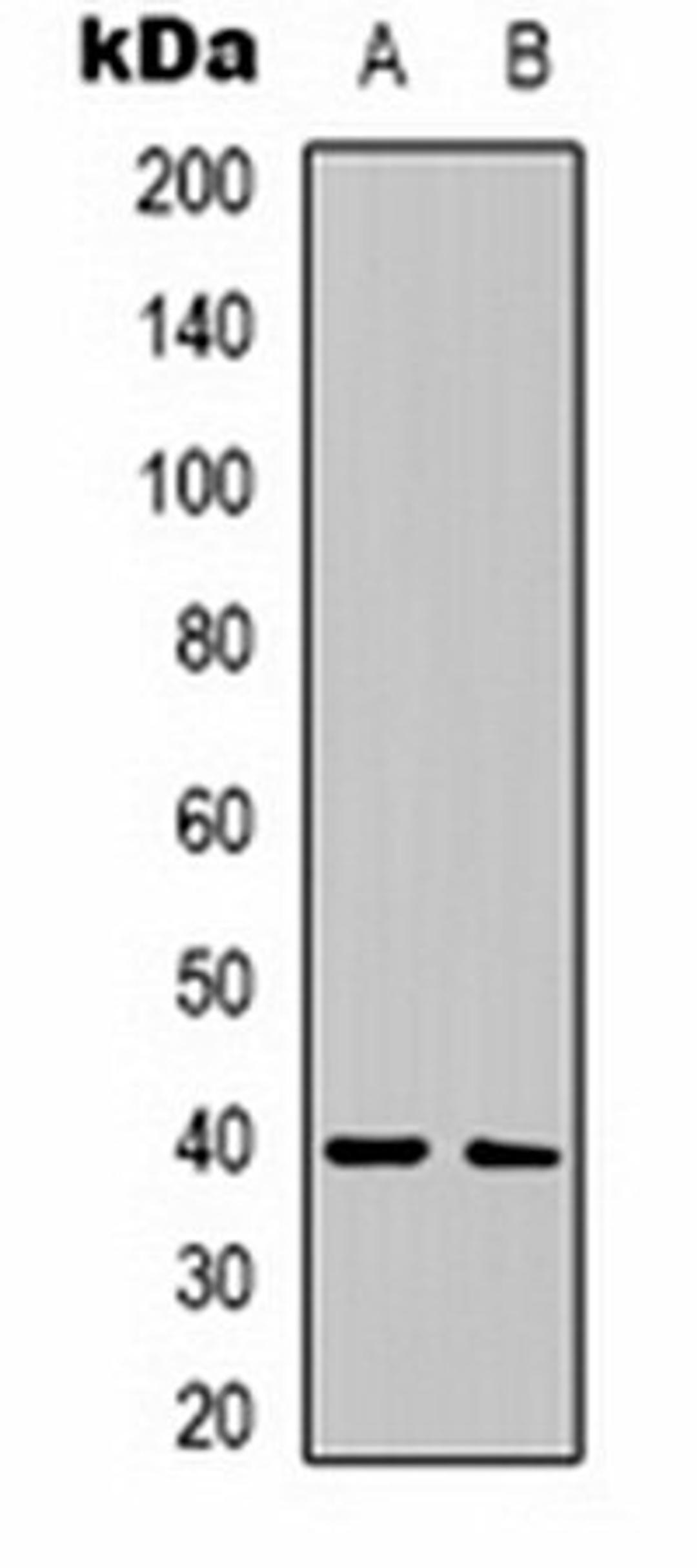 Western blot analysis of human brain (Lane 1), rat brain (Lane 2) whole cell lysates using CALHM1 antibody