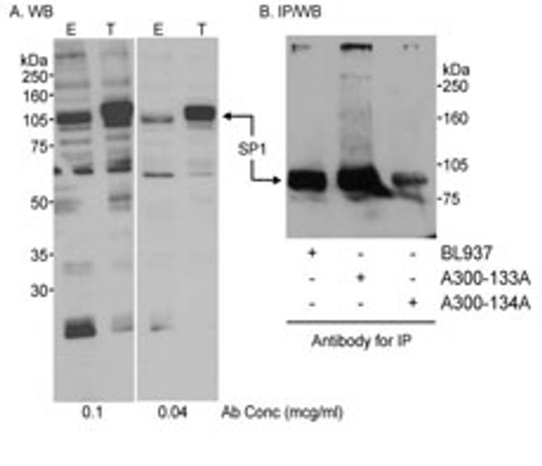 Detection of human SP1 by western blot and immunoprecipitation.