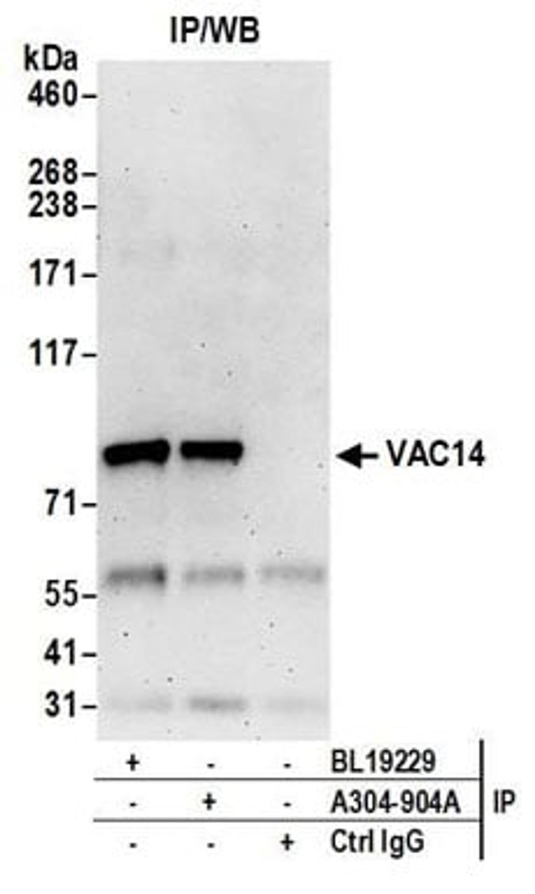 Detection of human VAC14 by western blot of immunoprecipitates.