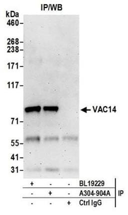 Detection of human VAC14 by western blot of immunoprecipitates.