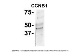 Antibody used in IP on Mouse Brain at: 1:50.