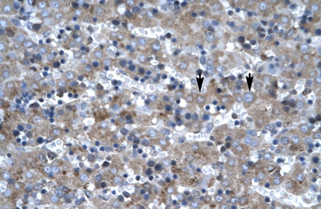 Antibody used in IHC on Human Liver.