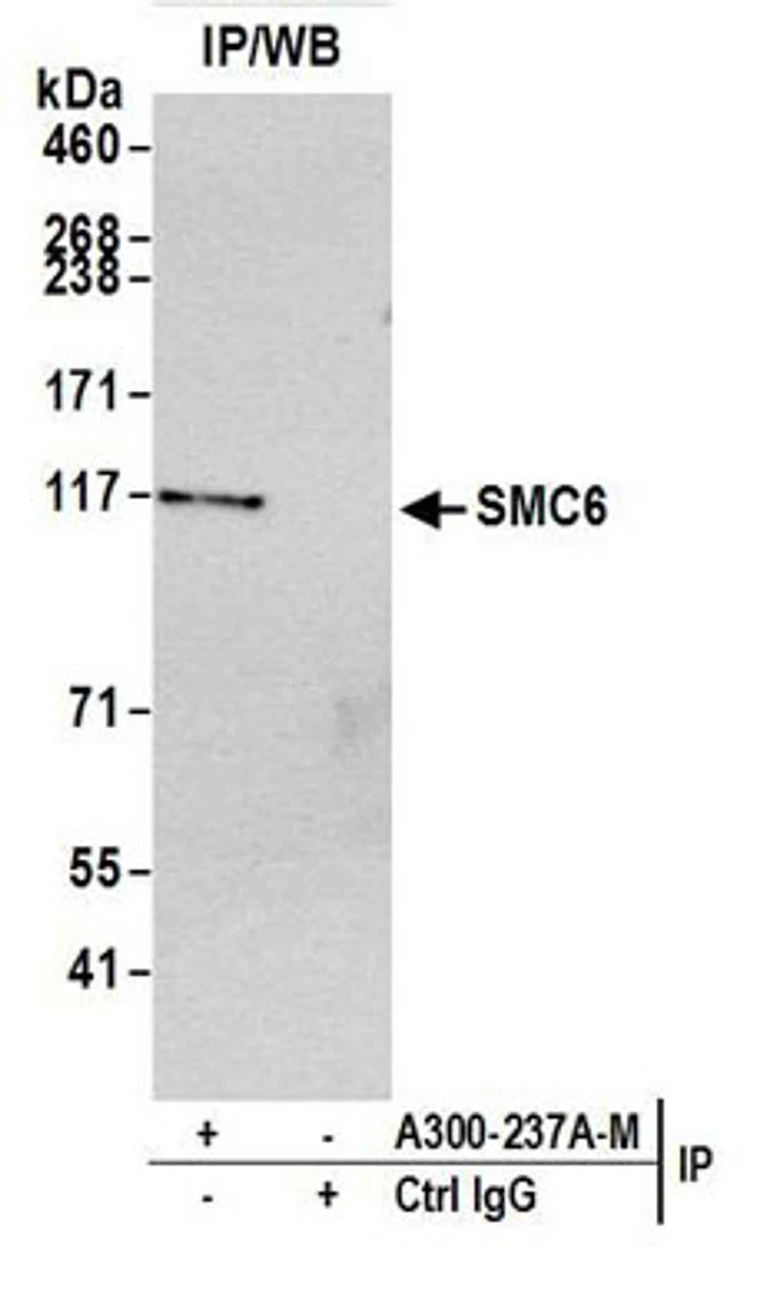 Detection of Human SMC6 by Western Blot of Immunoprecipitates.