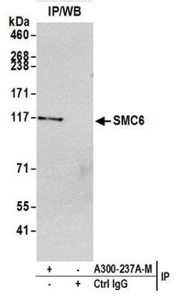 Detection of Human SMC6 by Western Blot of Immunoprecipitates.