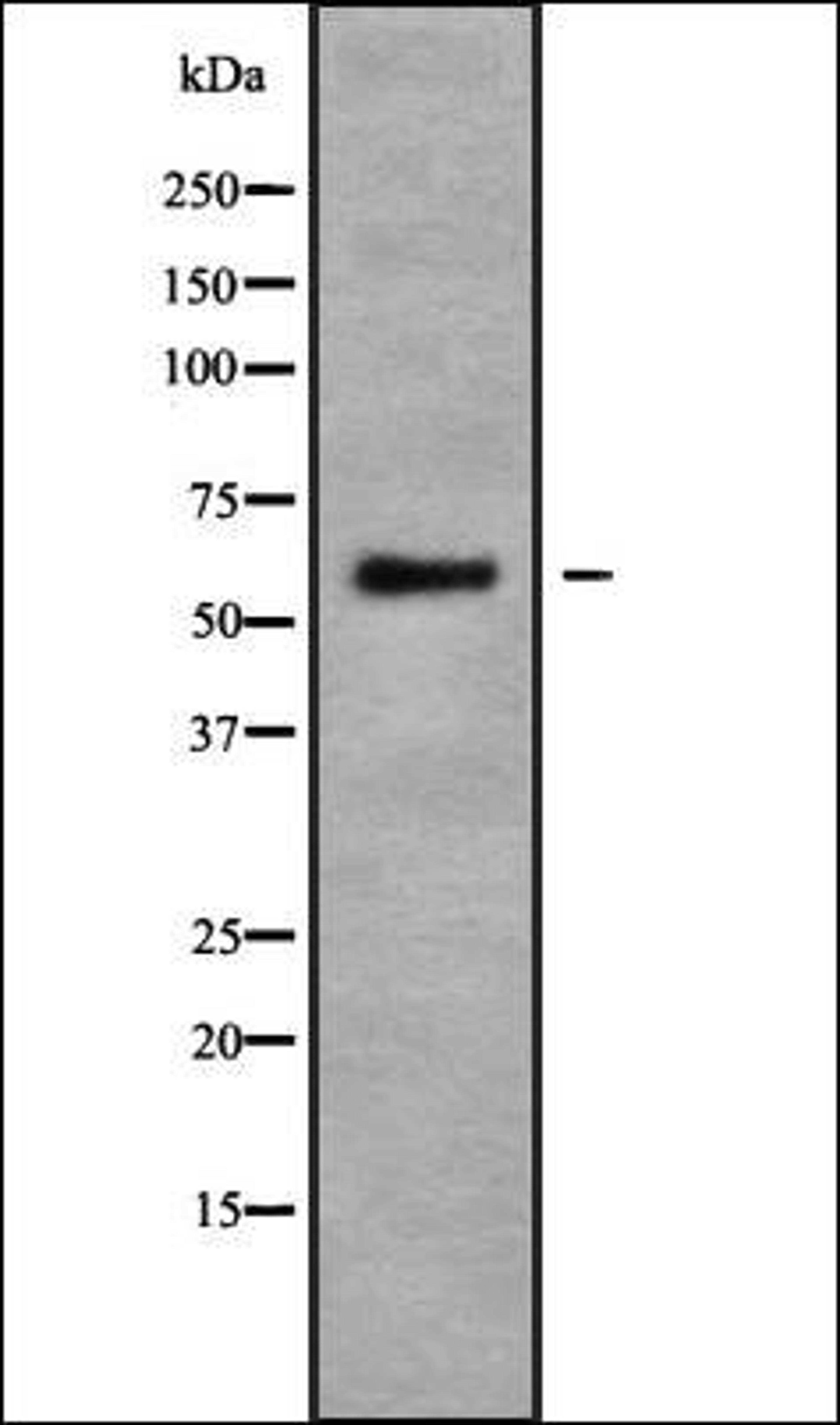 Western blot analysis of HuvEc whole cell lysates using USP17L antibody