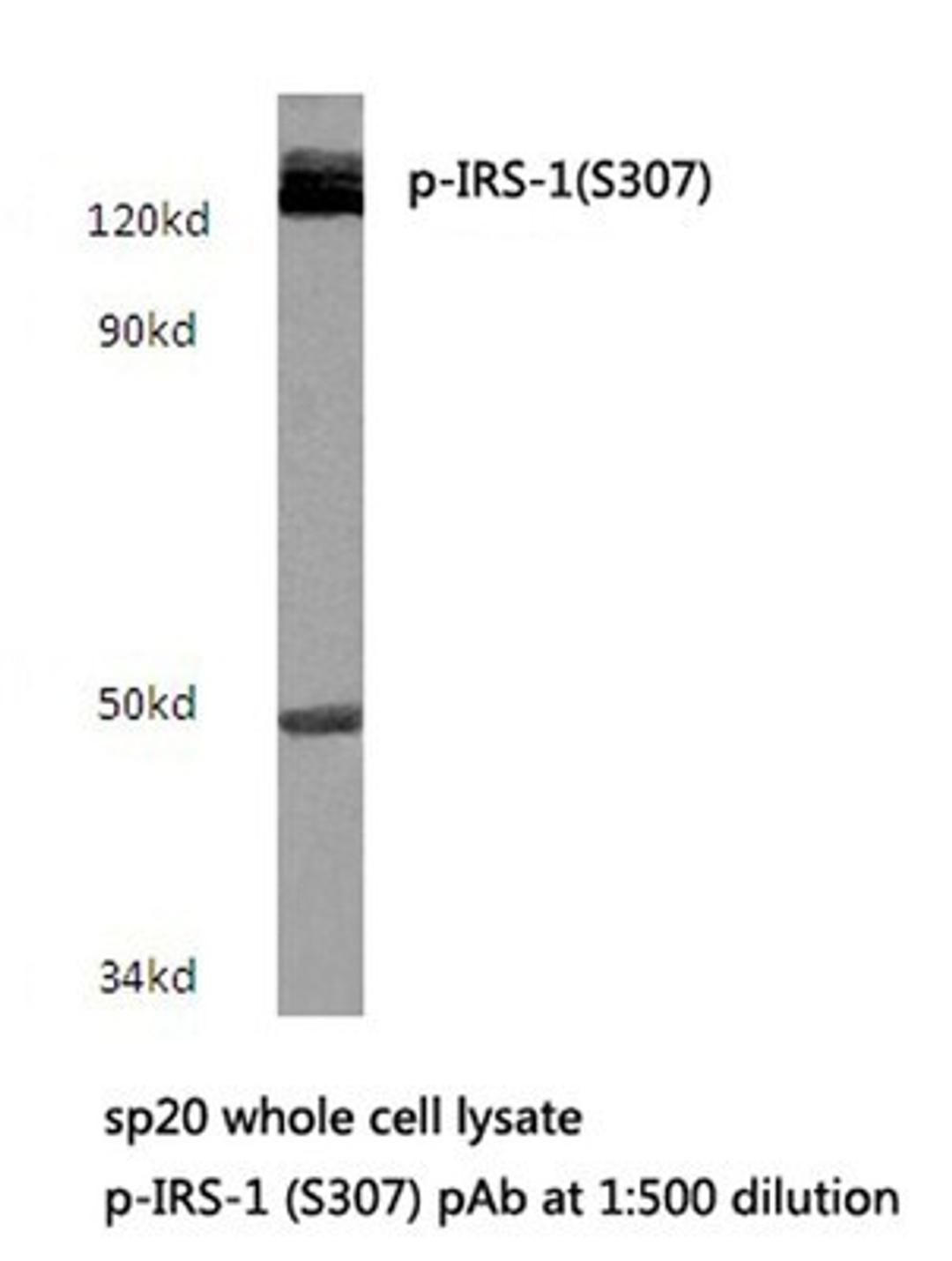 Western Blot: IRS1 [p Ser307] Antibody [NBP1-51429] - IRS-1 (S307) pAb in extracts from sp20 cells.