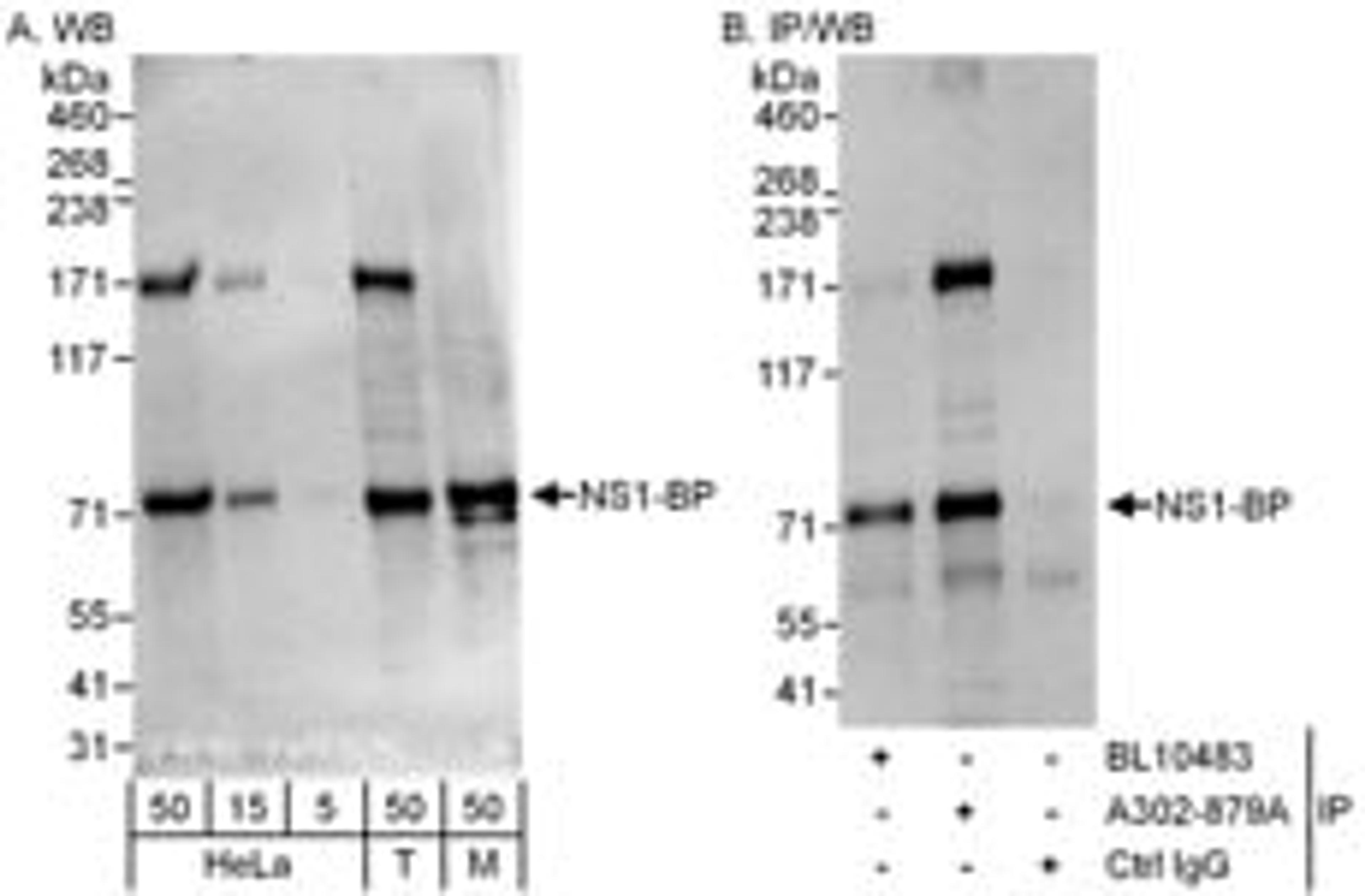 Detection of human and mouse NS1-BP by western blot (h&m) and immunoprecipitation (h).