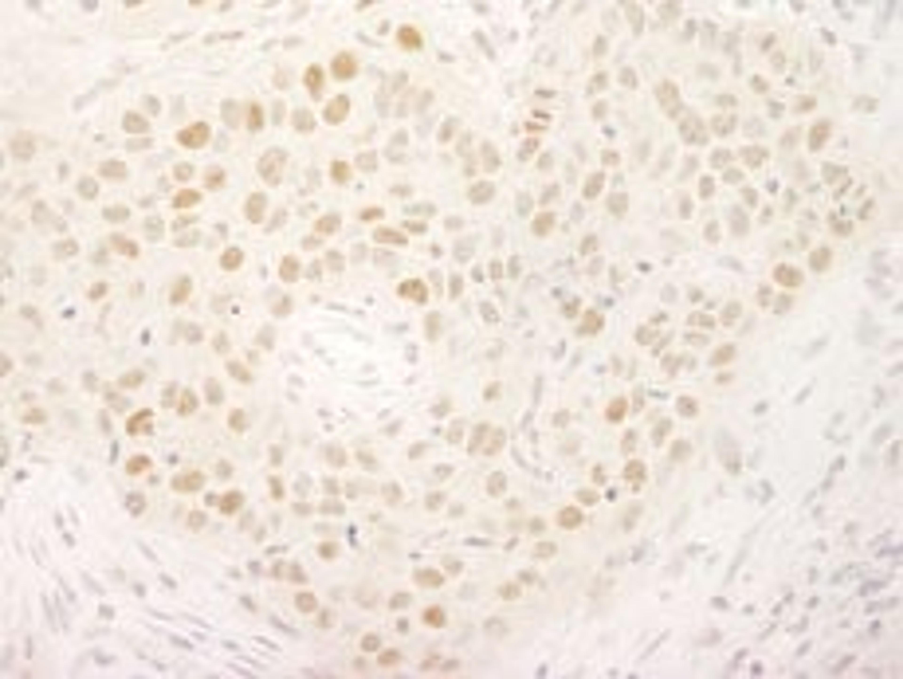 Detection of human KIFC1/MKLP2 by immunohistochemistry.