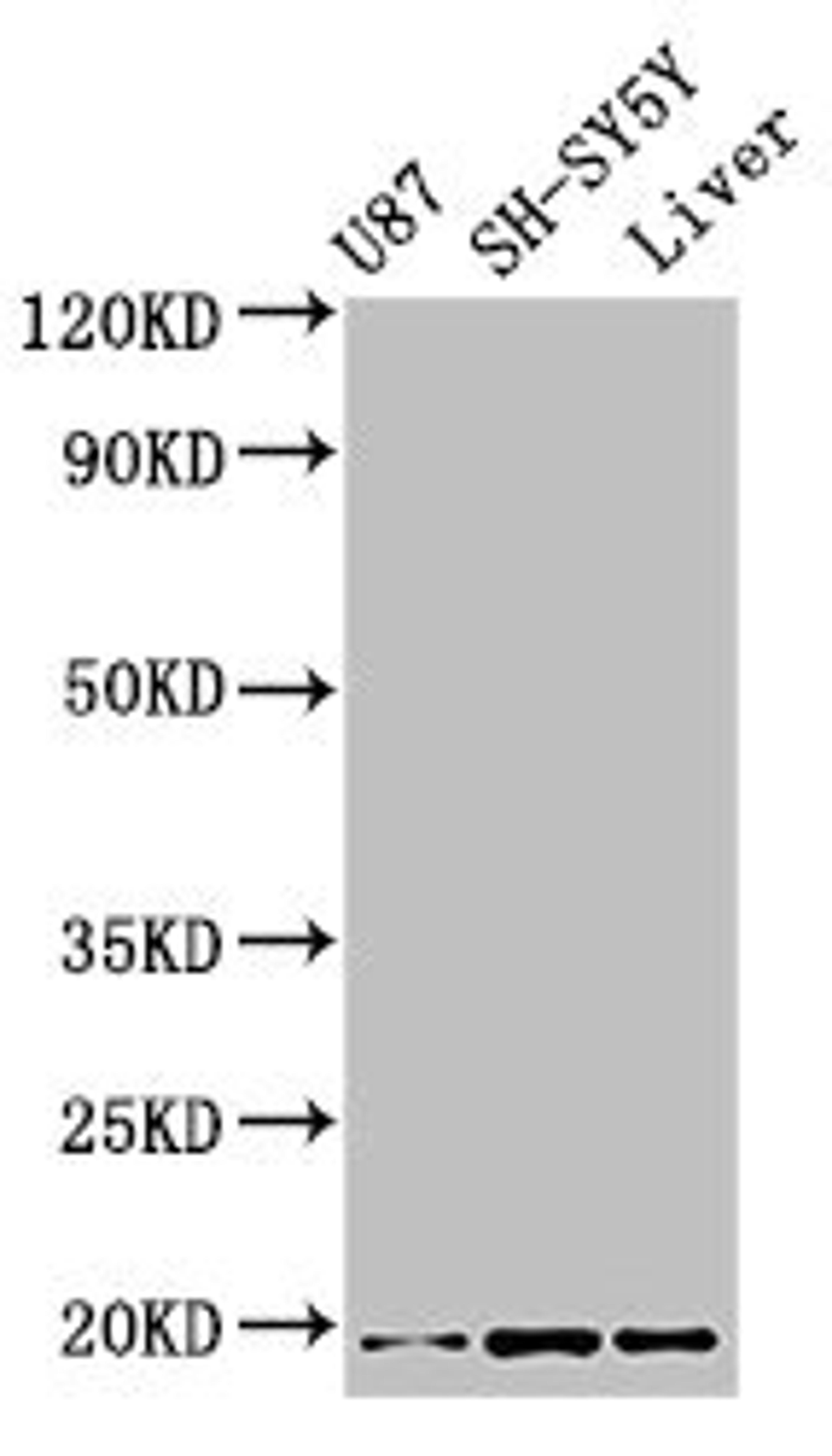 Western Blot. Positive WB detected in: U87 whole cell lysate, SH-SY5Y whole cell lysate, Mouse liver tissue. All lanes: TSLP antibody at 3.4µg/ml. Secondary. Goat polyclonal to rabbit IgG at 1/50000 dilution. Predicted band size: 19, 8 kDa. Observed band size: 19 kDa