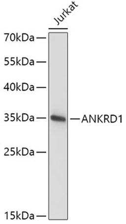 Western blot - ANKRD1 antibody (A6192)