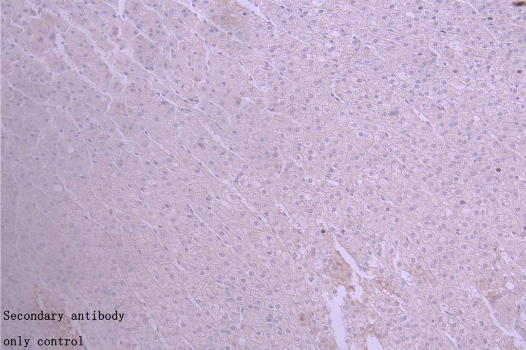 Immunohistochemistry of paraffin-embedded human placenta tissue using CSB-PA11737A0Rb at dilution of 1:50
