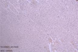 Immunohistochemistry of paraffin-embedded human placenta tissue using CSB-PA11737A0Rb at dilution of 1:50