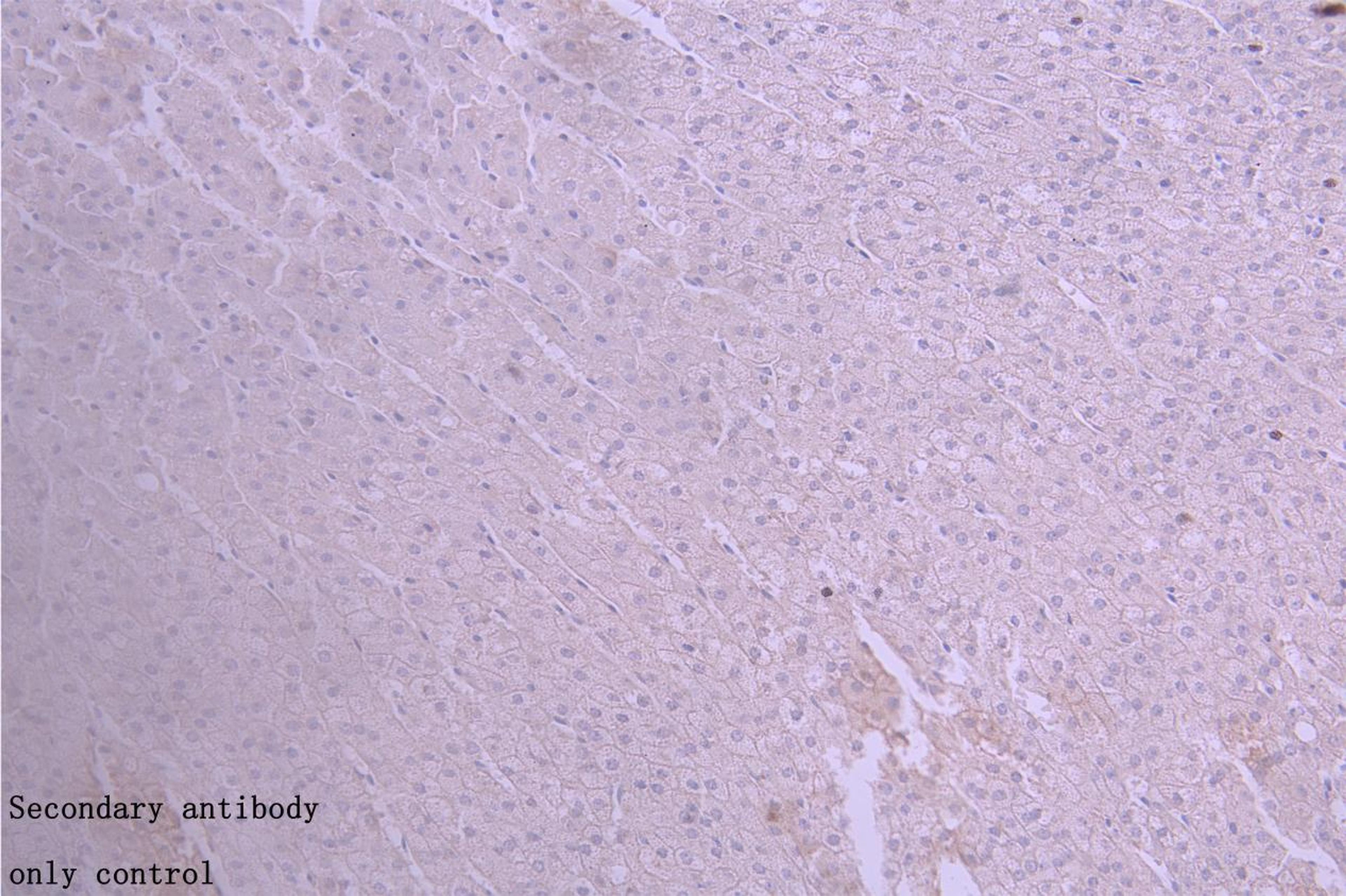 Immunohistochemistry of paraffin-embedded human placenta tissue using CSB-PA11737A0Rb at dilution of 1:50