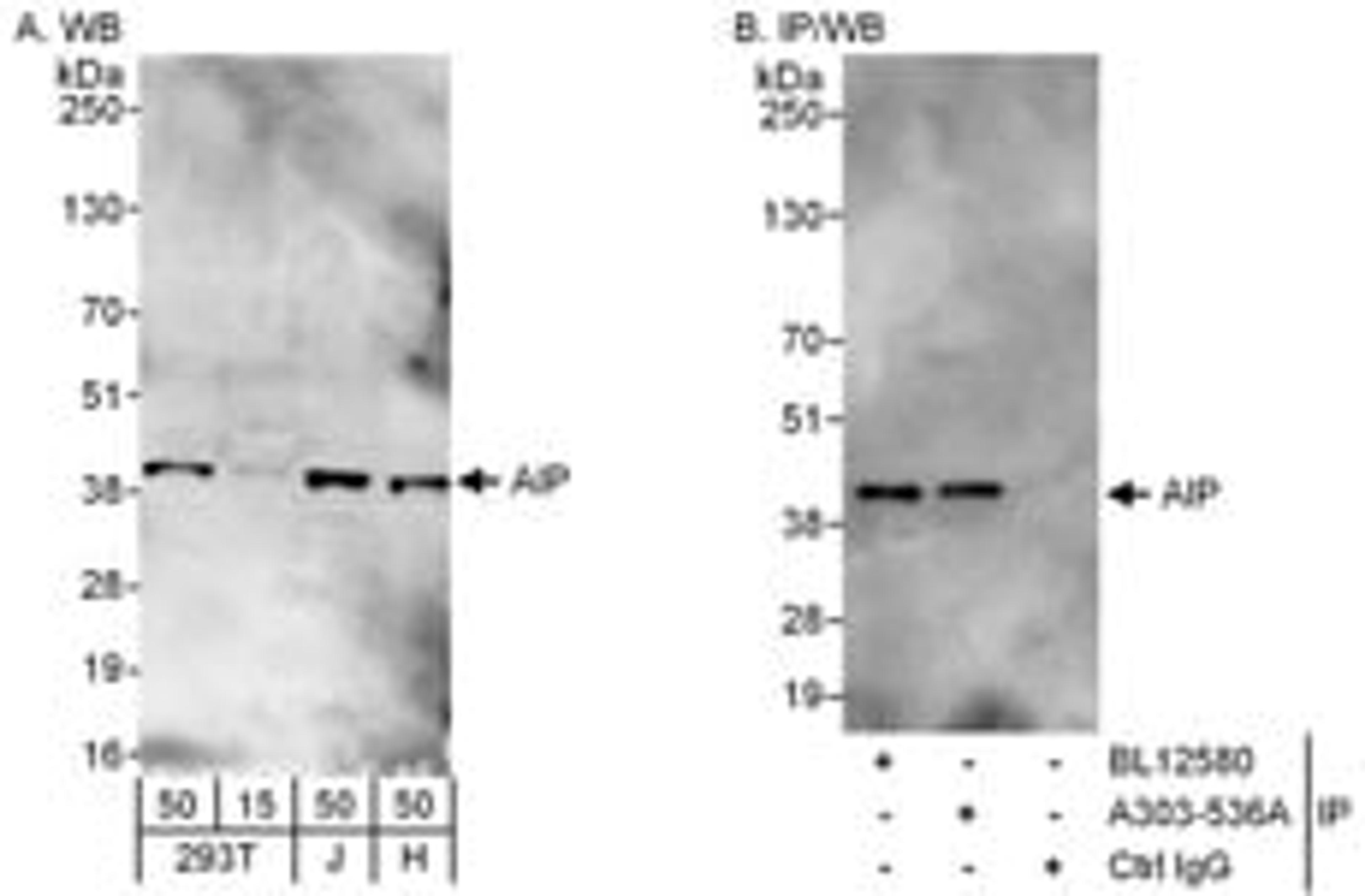 Detection of human AIP by western blot and immunoprecipitation.