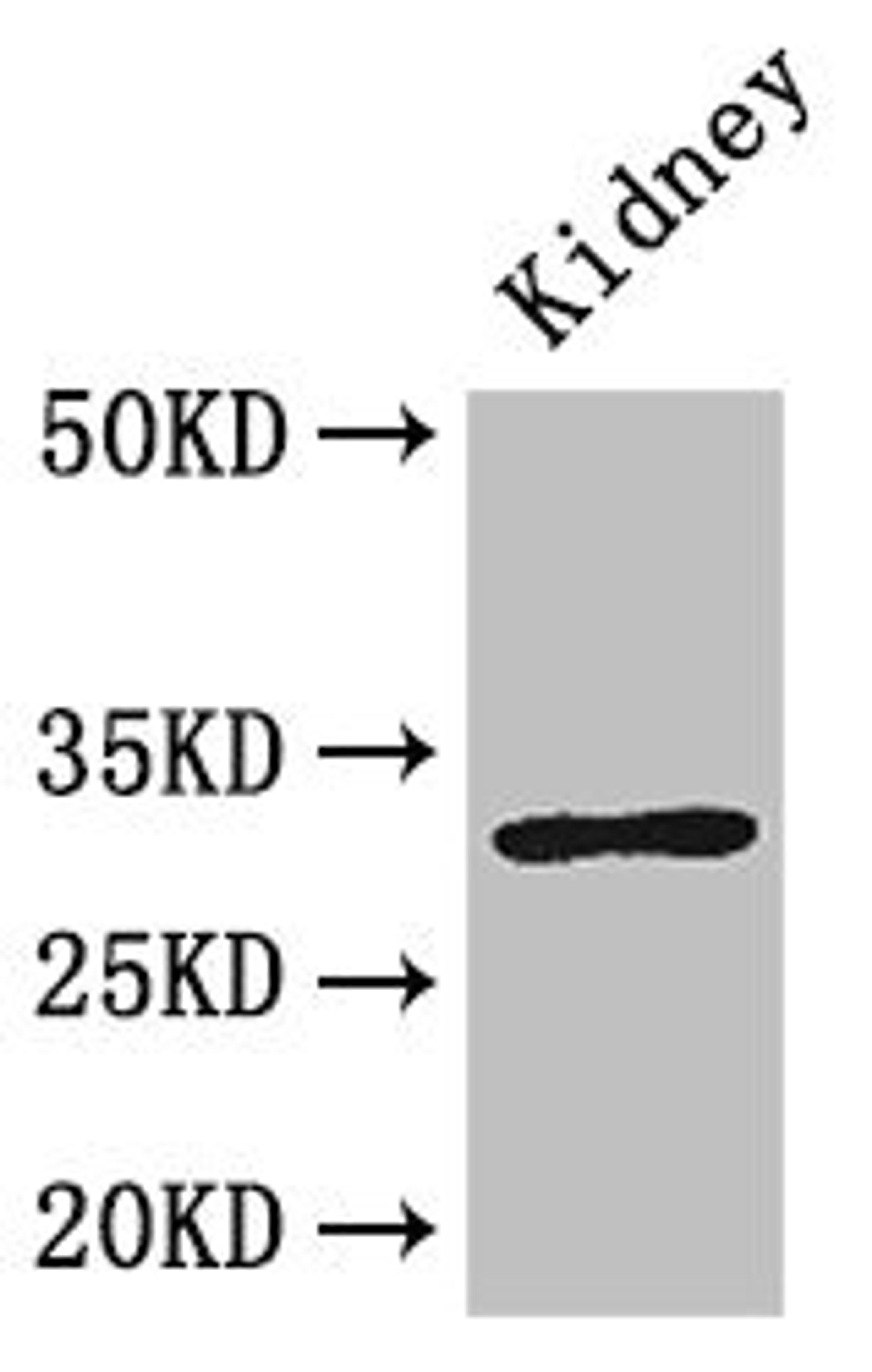 Western Blot. Positive WB detected in: Mouse kidney tissue. All lanes: FAM151B antibody at 2.6µg/ml. Secondary. Goat polyclonal to rabbit IgG at 1/50000 dilution. Predicted band size: 32 kDa. Observed band size: 32 kDa