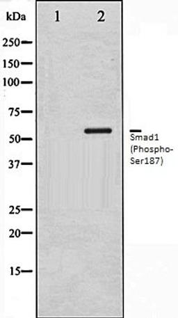 Western blot analysis of Mouse muscle tissue lysates using Smad1 (Phospho-Ser187) antibody, The lane on the left is treated with the antigen-specific peptide.