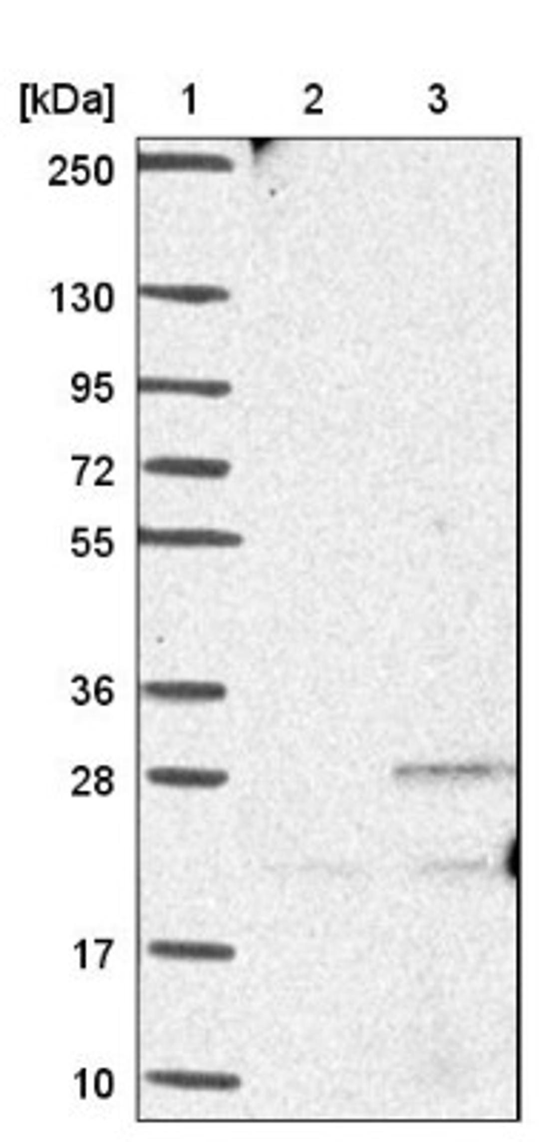 Western Blot: Ankyrin repeat domain 39 Antibody [NBP1-91673] - Lane 1: Marker [kDa] 250, 130, 95, 72, 55, 36, 28, 17, 10<br/>Lane 2: Negative control (vector only transfected HEK293T lysate)<br/>Lane 3: Over-expression lysate (Co-expressed with a C-terminal myc-DDK tag (~3.1 kDa) in mammalian HEK293T cells, LY413966)