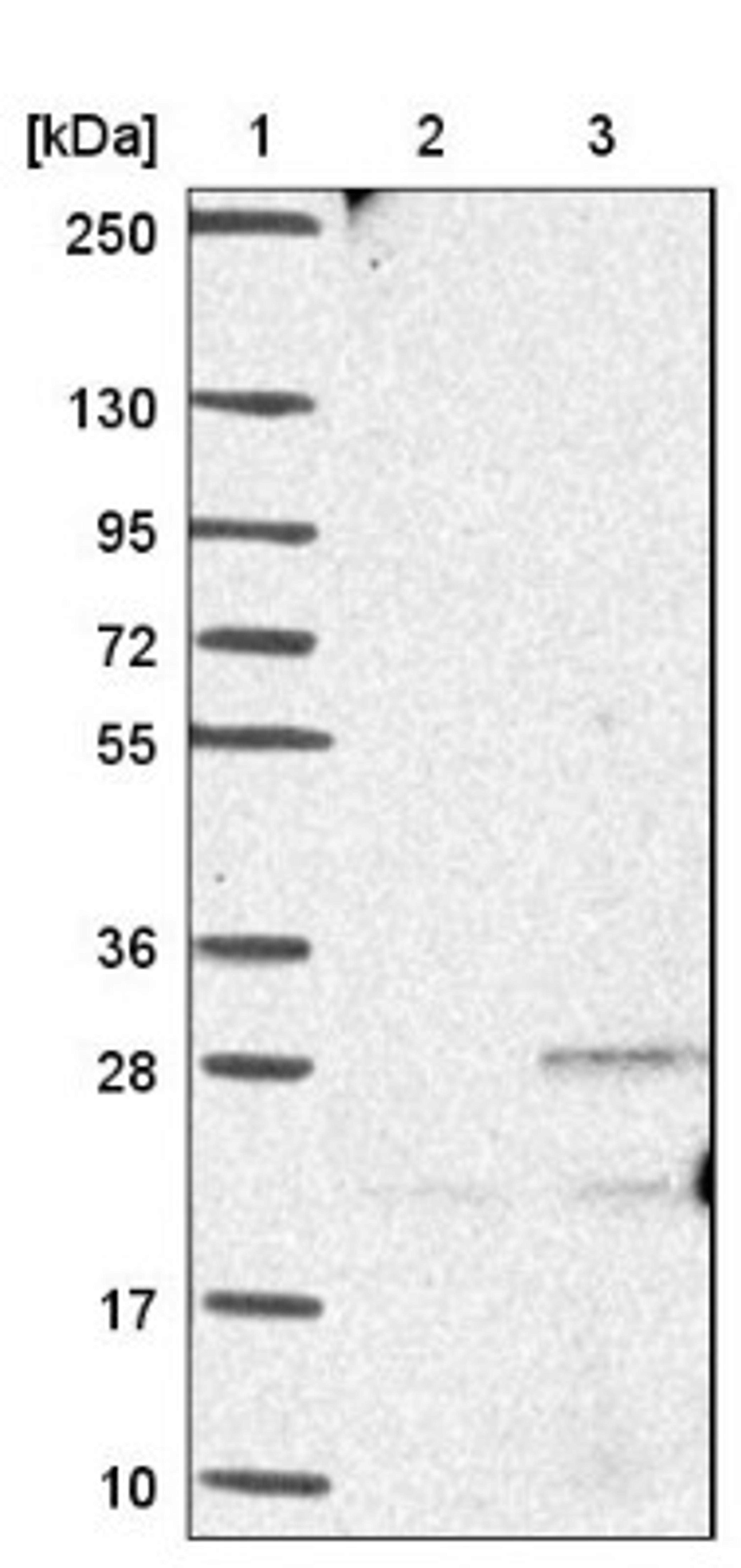 Western Blot: Ankyrin repeat domain 39 Antibody [NBP1-91673] - Lane 1: Marker [kDa] 250, 130, 95, 72, 55, 36, 28, 17, 10<br/>Lane 2: Negative control (vector only transfected HEK293T lysate)<br/>Lane 3: Over-expression lysate (Co-expressed with a C-terminal myc-DDK tag (~3.1 kDa) in mammalian HEK293T cells, LY413966)