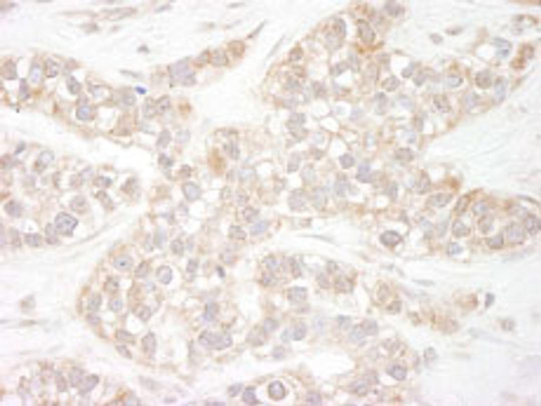 Detection of human Flightless-1 by immunohistochemistry.