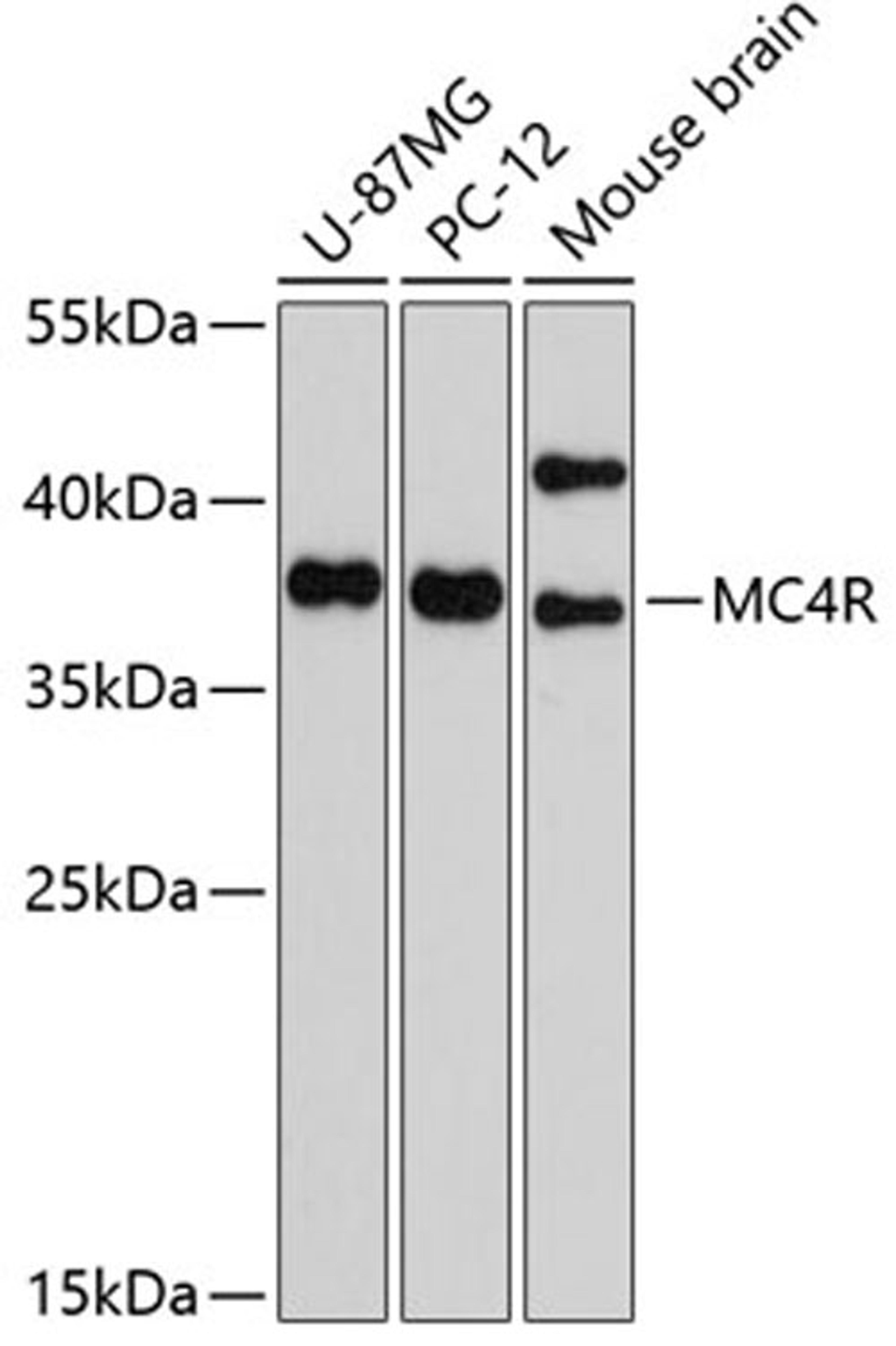 Western blot - MC4R Antibody (A10228)