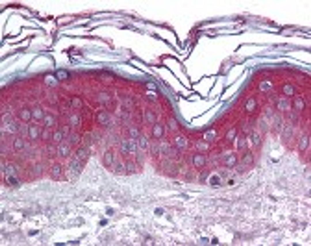 Immunohistochemistry staining of ARHGEF11 in skin tissue using ARHGEF11 Antibody.