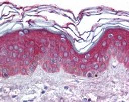 Immunohistochemistry staining of ARHGEF11 in skin tissue using ARHGEF11 Antibody.