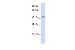 Antibody used in WB on Human 293T at 0.2-1 ug/ml.